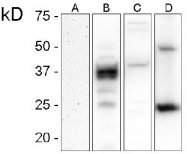 DB 081-0.05 - CD230 / PrP