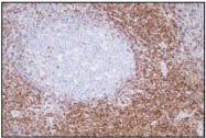 DB 082-0.1 - CD3