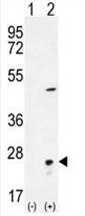 AP54522PU-N - Visinin-like protein 1 / HLP3