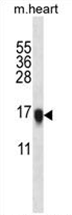 AP54522PU-N - Visinin-like protein 1 / HLP3