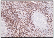 DB 085-1 - CD8