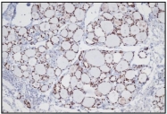 DB 089-1 - TTF1 / NKX2A