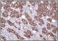 DB 094-0.1 - CD340 / ERBB2 / HER2