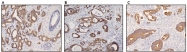 DB 098-0.2 - Cytokeratin 8