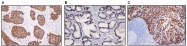 DB 099-0.2 - Cytokeratin 14