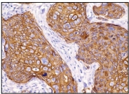 DB 100-0.5 - Cytokeratin 16
