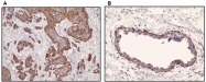 DB 101-0.2 - Cytokeratin 17