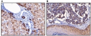 DB 102-0.2 - Cytokeratin 18