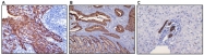 DB 103-0.2 - Cytokeratin 19
