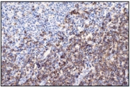 DB 114-0.5 - CD7