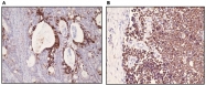 DB 119-1 - Cytokeratin 20