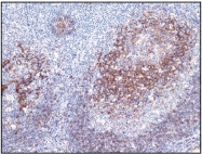 DB 135-1 - CD23