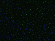 AM03092BT-N - CD105 / Endoglin