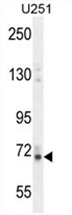 AP54513PU-N - Vitrin (VIT)