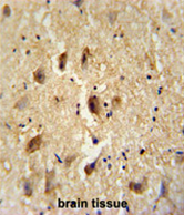 AP54513PU-N - Vitrin (VIT)