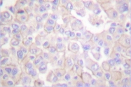 AP06063PU-N - Claudin-2 / CLDN2