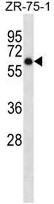 AP50261PU-N - Arylsulfatase D