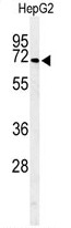 AP50262PU-N - Arylsulfatase I