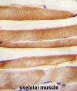AP50263PU-N - ARV1