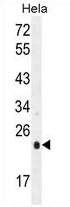 AP54481PU-N - UQCRFS1 (Complex III subunit Rieske)