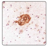AP31802PU-N - Amyloid beta