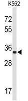 AP50294PU-N - ATP1B2