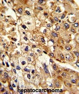 AP50294PU-N - ATP1B2