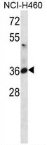 AP50295PU-N - CD298 / ATP1B3