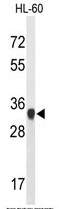 AP50298PU-N - ATP synthase subunit gamma