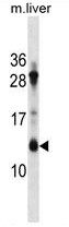 AP50300PU-N - ATP synthase proteolipid P1