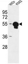 AP50306PU-N - ATP6V1B1