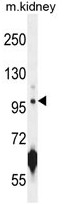 AP50310PU-N - CARNS1 / ATPGD1