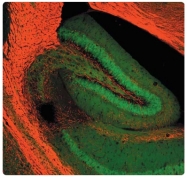 AP31809PU-N - Myelin Basic Protein