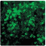 AP31811PU-N - Netrin-1