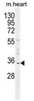 AP54478PU-N - Uridine phosphorylase 2 (UPP2)