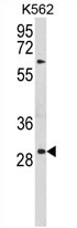 AP54476PU-N - Uroplakin-1b (UPK1B)