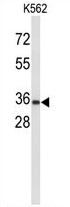 AP54475PU-N - Uroplakin-1a (UPK1A)