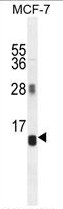 AP50316PU-N - AVP-induced protein 1