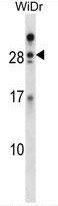AP50321PU-N - Azurocidin