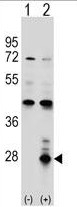 AP50321PU-N - Azurocidin