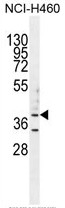AP50323PU-N - B3GALT5
