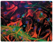AP31816PU-N - Neuron specific enolase