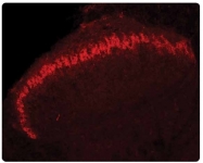 AP31817PU-N - ACPP / Prostatic acid phosphatase