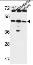AP50329PU-N - B3GNT5 / Lc3 Synthase