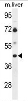 AP50329PU-N - B3GNT5 / Lc3 Synthase