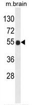 AP50330PU-N - B3GNT6 / Core 3 Synthase