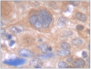 AP01157PU-N - Interleukin-6 / IL6