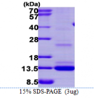 AR39140PU-L - Matrix Gla Protein