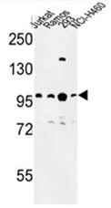 AP50355PU-N - Bcl-11A