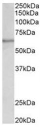 AP31773PU-N - SLC47A2 / MATE2